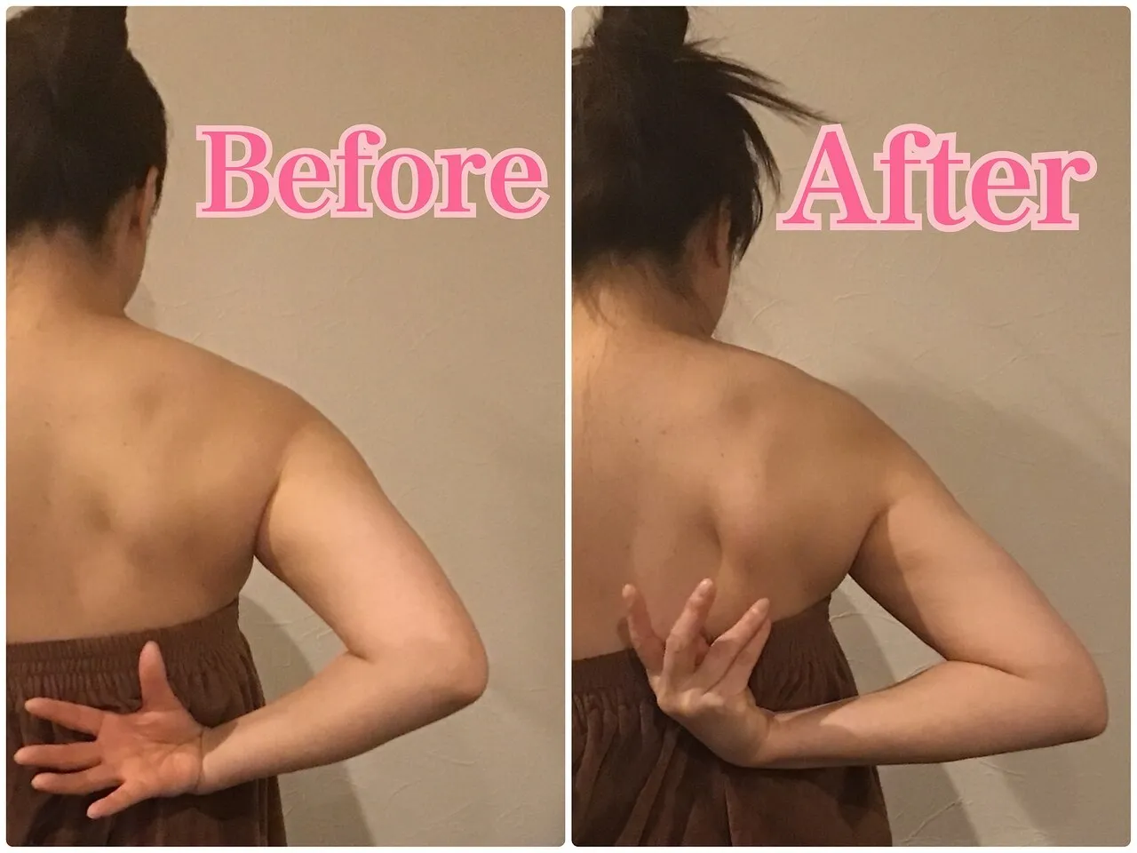 施術前後の比較 2
