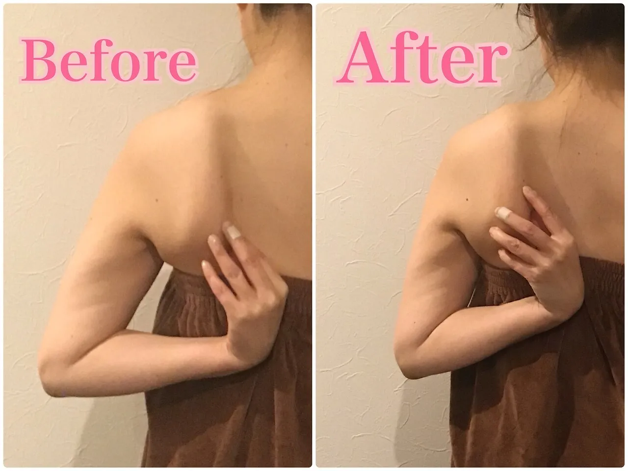 施術前後の比較 1
